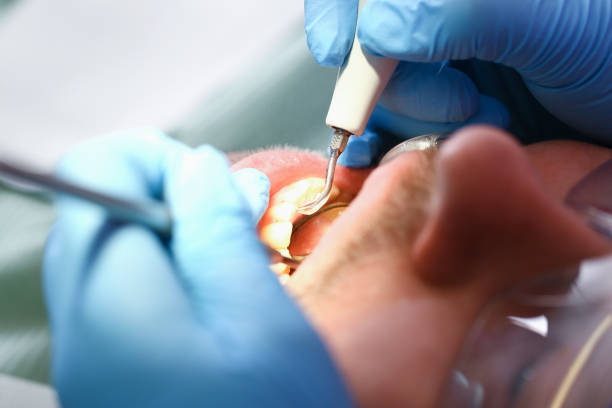 Best Weekend Emergency Dentist in Joanna, SC