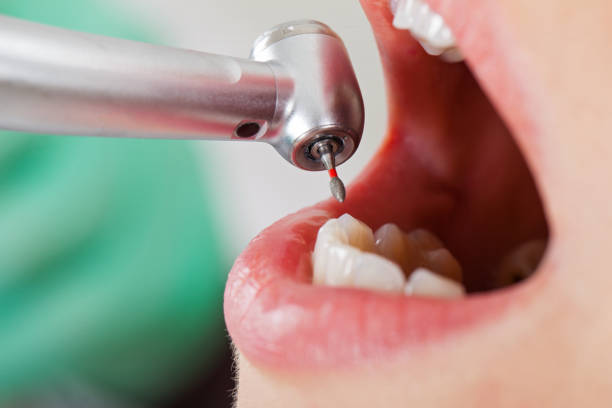 Best Emergency Cosmetic Dentistry in Joanna, SC